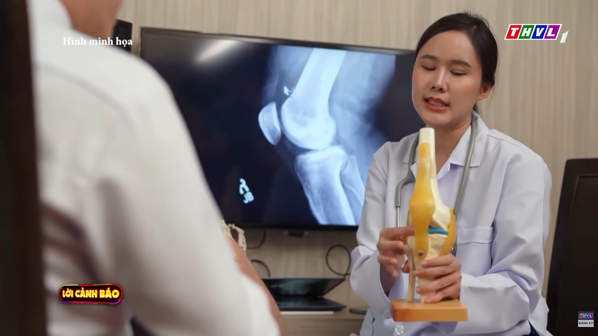 Lời Cảnh Báo: Đừng để thói quen “ngồi lỳ” khiến tuổi trẻ vướng vòng vây bệnh xương khớp